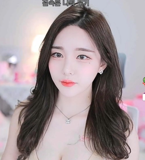 치아교정기 제거한 츄정 | 커뮤니티 | 아프리카TV e스포츠